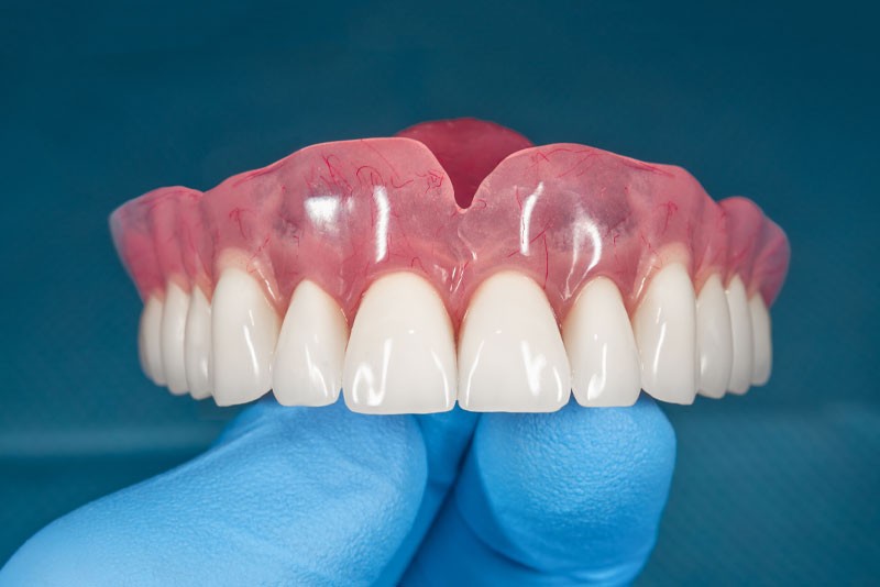 Full Mouth Dental Implants Near Me Portland OR