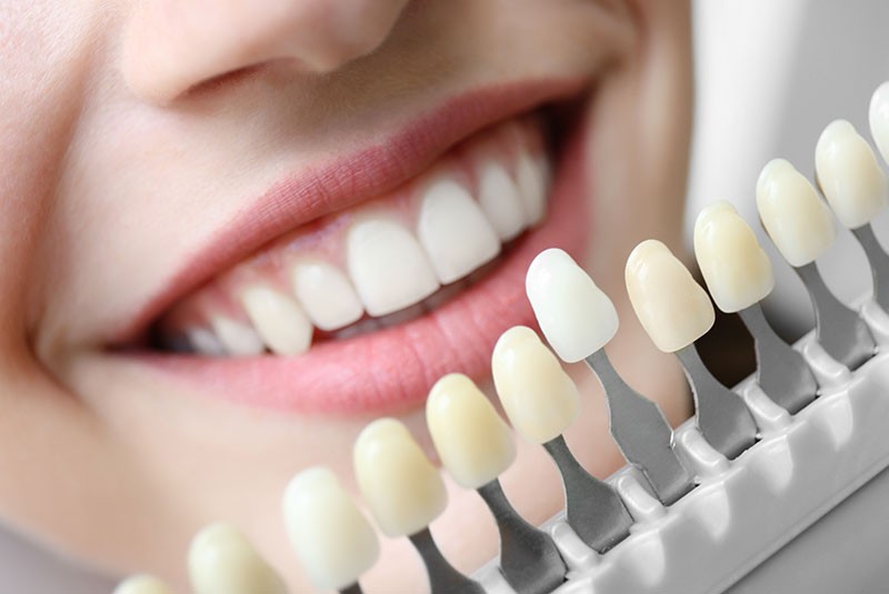 Your Journey to a Perfect Smile: Cosmetic Dentistry Near Me
