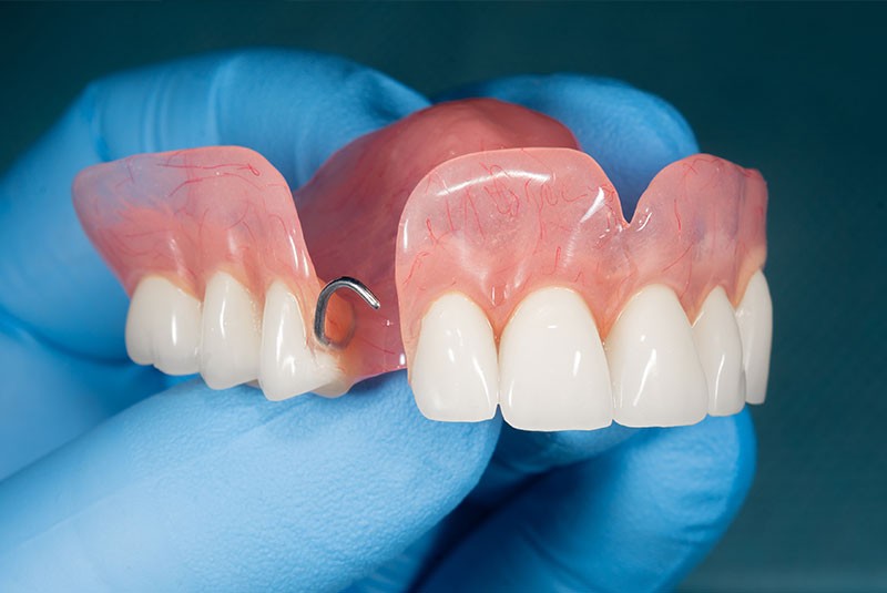 Dental Implants Near Me Hillsboro OR