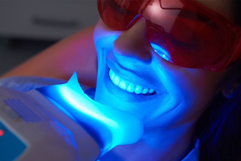 A person getting teeth whitening in Portland, OR