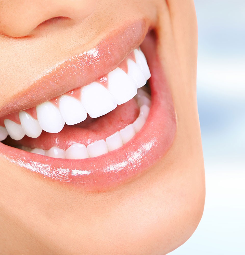 Teeth Alignment
