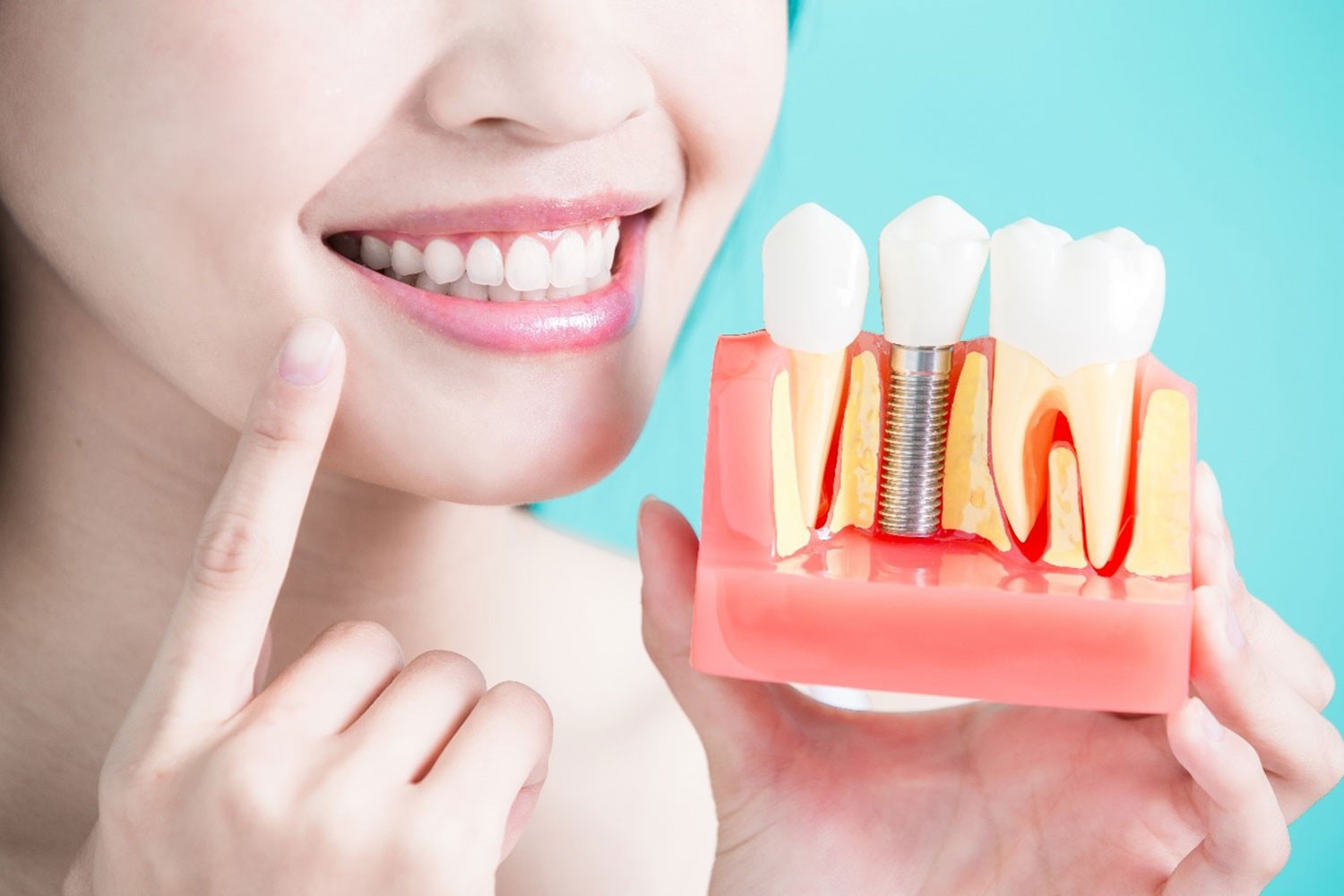 Cosmetic and Implant Dentistry of Portland, Oregon.