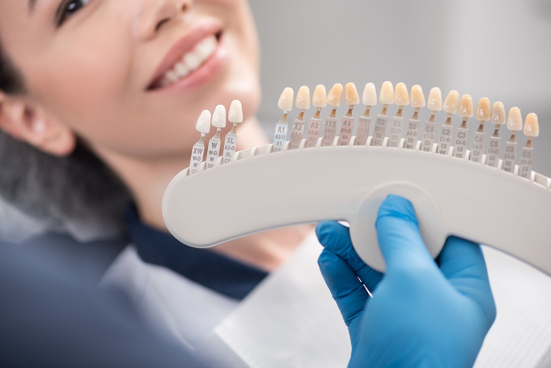 Things You Should Know About Full Mouth Dental Implants