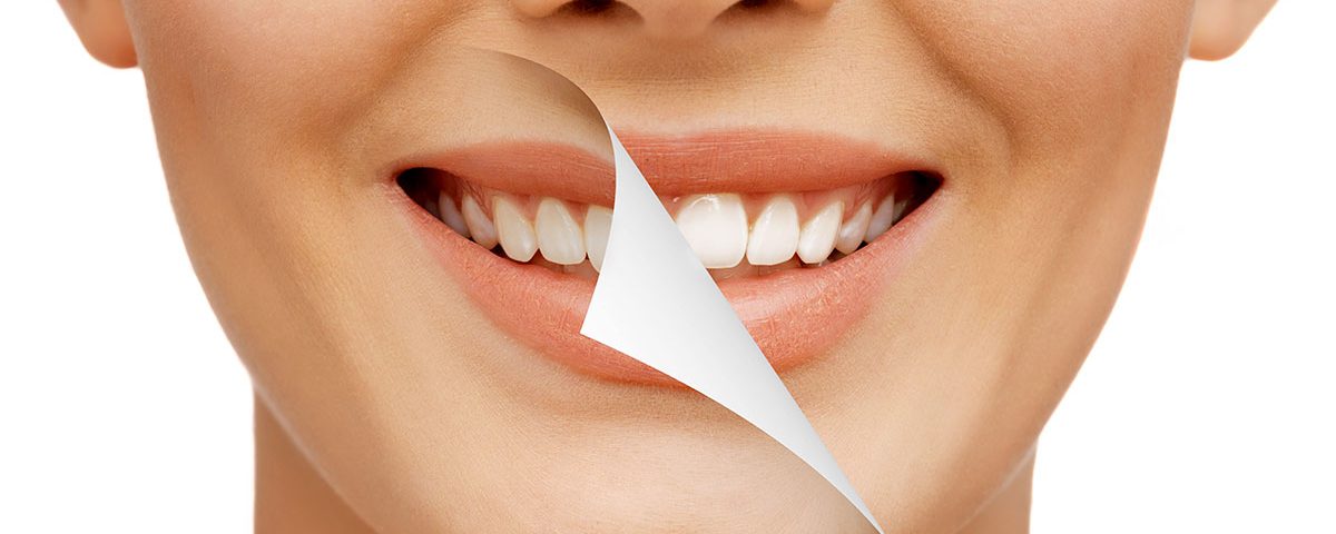 Is Teeth Whitening Safe? What Centerport Patients Need to Know