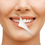 Is Teeth Whitening Safe? What Centerport Patients Need to Know